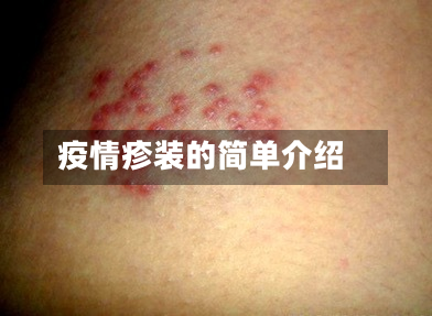 疫情疹装的简单介绍-第3张图片